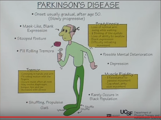 Sintomi del Parkinson