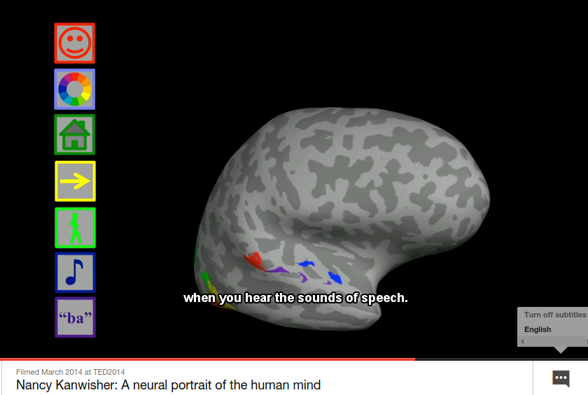 Cosa abbiamo imparato sul cervello con la fMRI