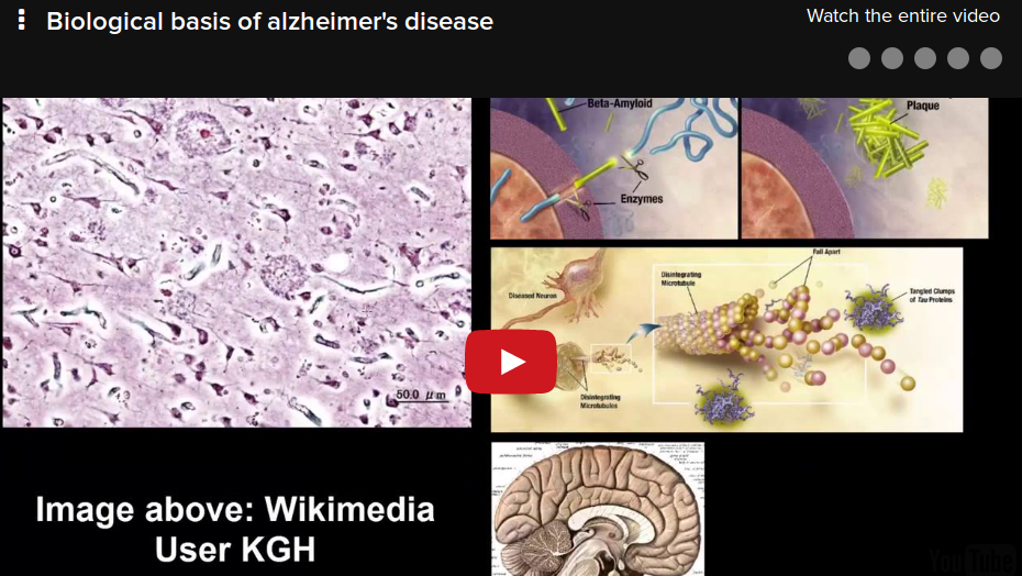 Basi biologiche dell'Alzheimer